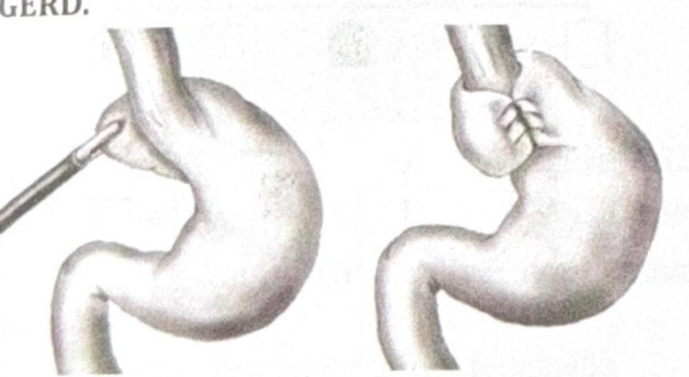 Image for question 5