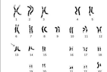 Image for question 1015