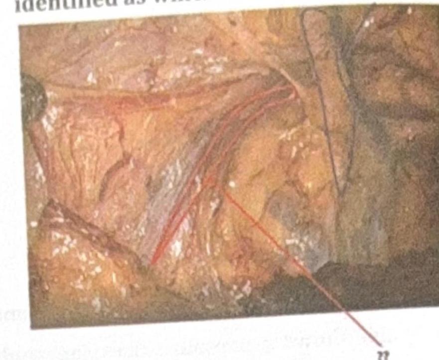 Image for question 3