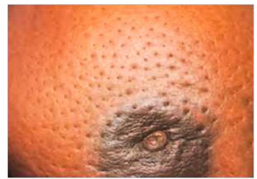 Image for question 864