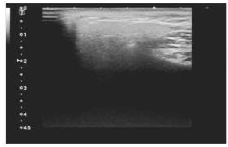 Image for question 2