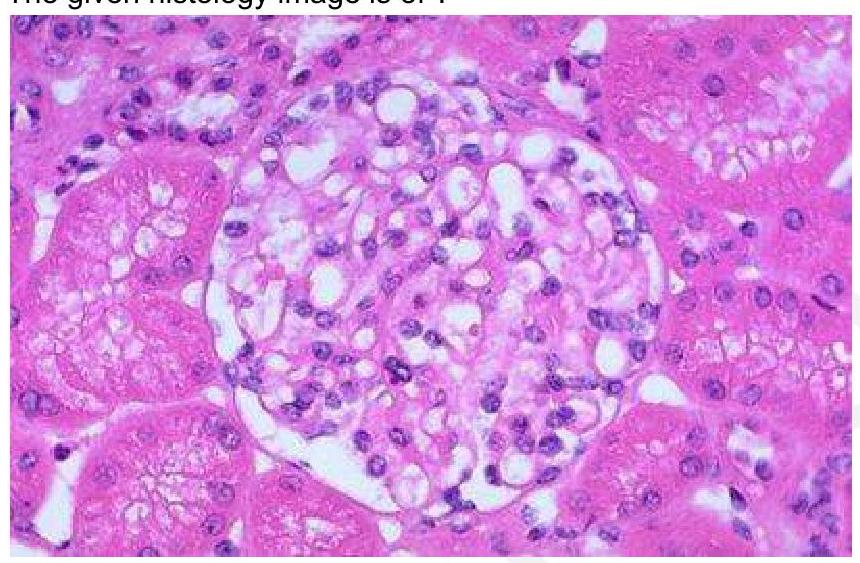 Image for question 8