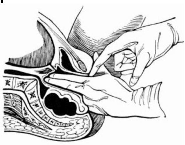 Image for question 66