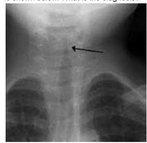 Image for question 7