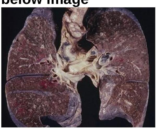 Image for question 457