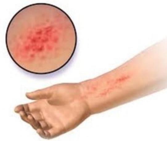 Image for question 2