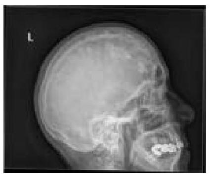 Image for question 183