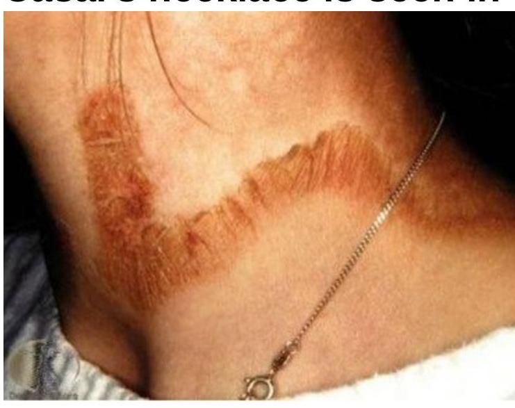 Image for question 249