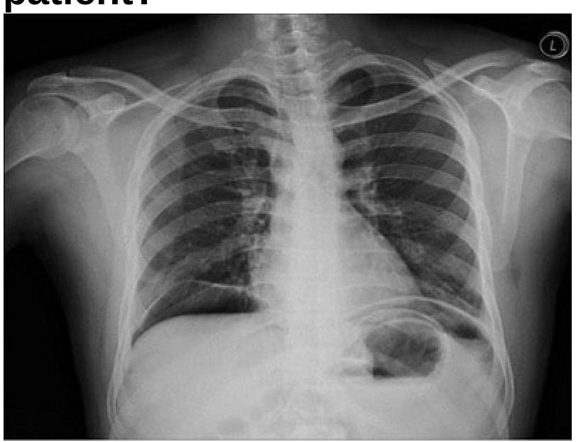 Image for question 7