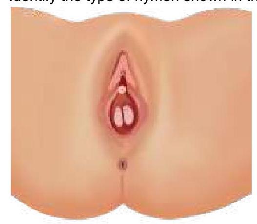 Image for question 5