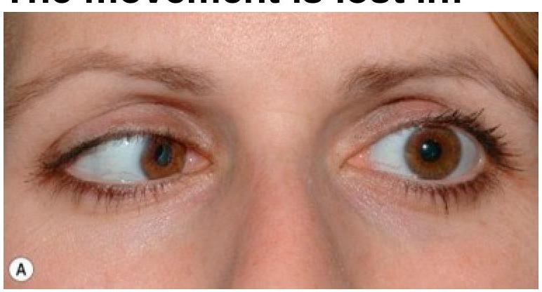 Image for question 43