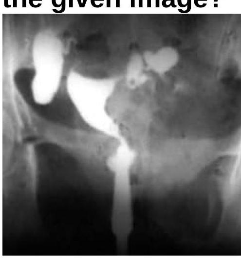 Image for question 5