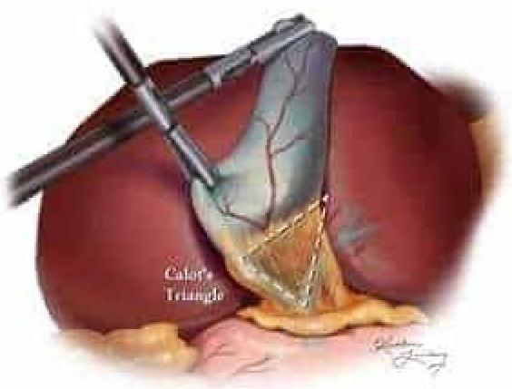 Image for question 4