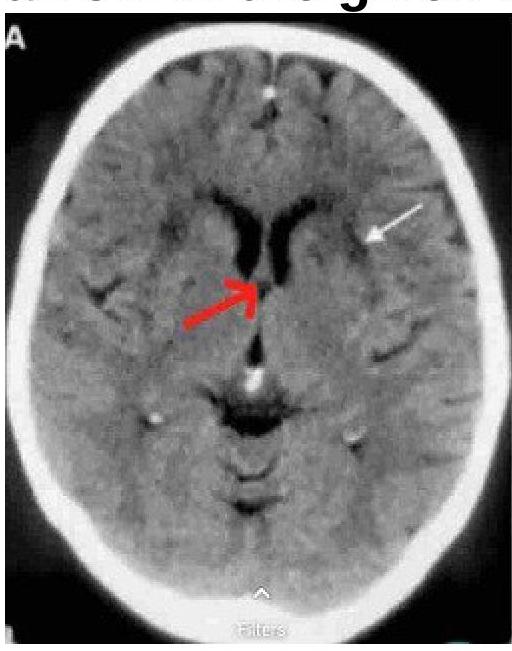 Image for question 9