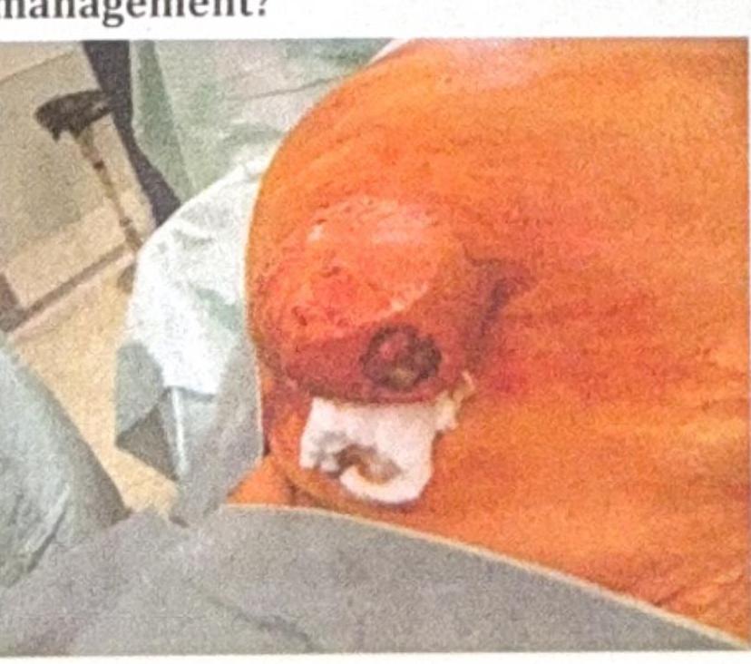 Image for question 5