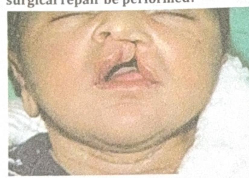 Image for question 11