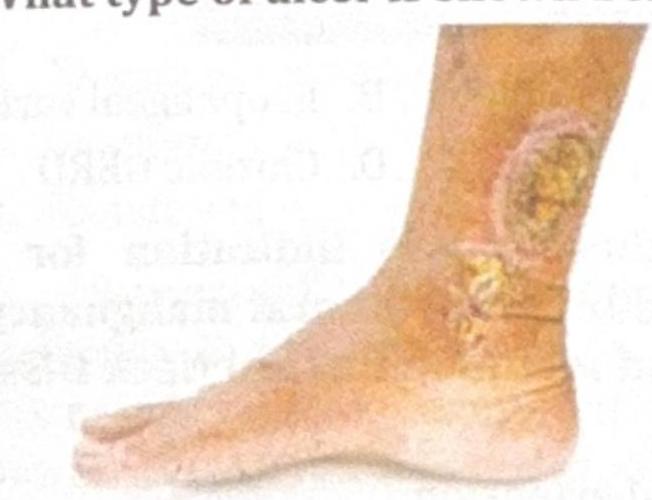 Image for question 7