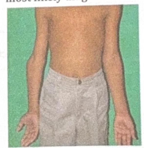 Image for question 7