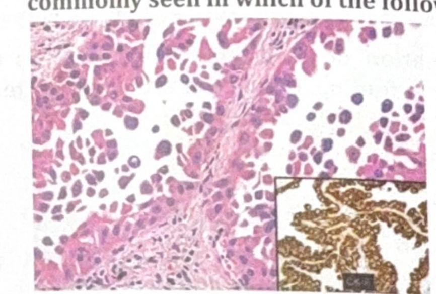 Image for question 6