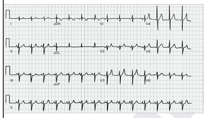 Image for question 1