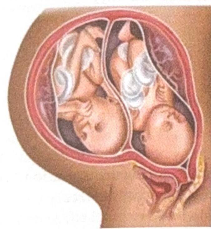 Image for question 8