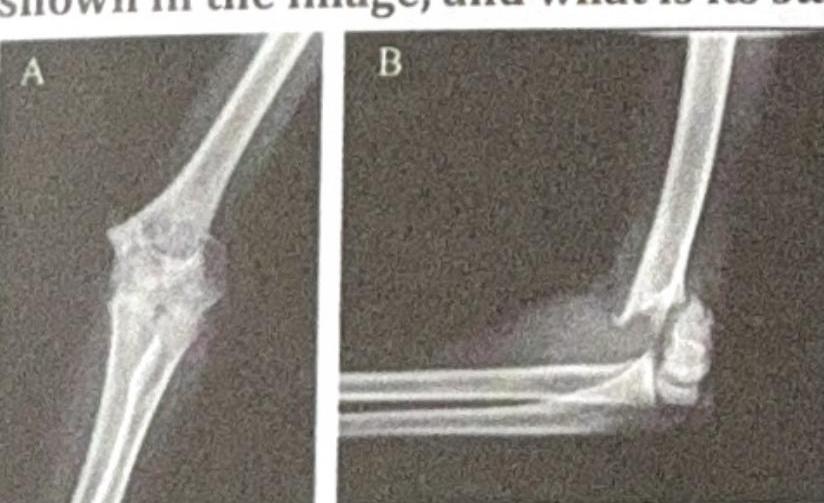 Image for question 5