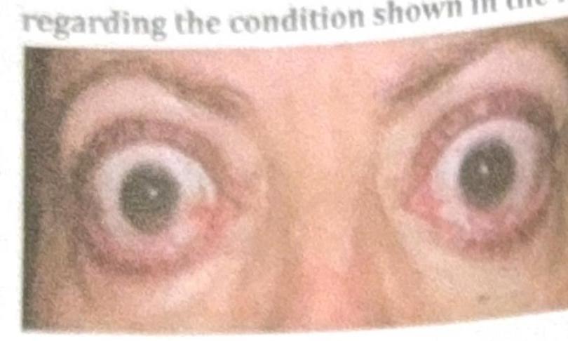 Image for question 1