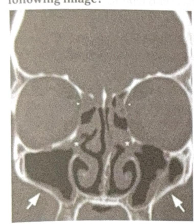 Image for question 7